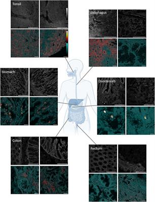 Revisiting ameloblastin; addressing the EMT-ECM axis above and beyond oral biology